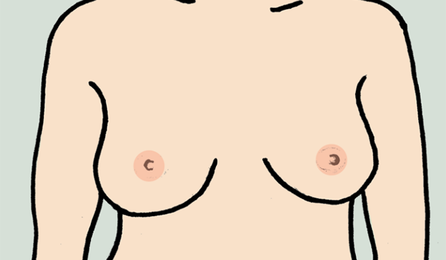 Breast screening